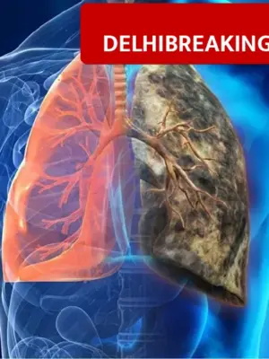 Delhi Men Beware, Doctors List 3 Cancers Spreading Rapidly Due to Pollution and Lifestyle