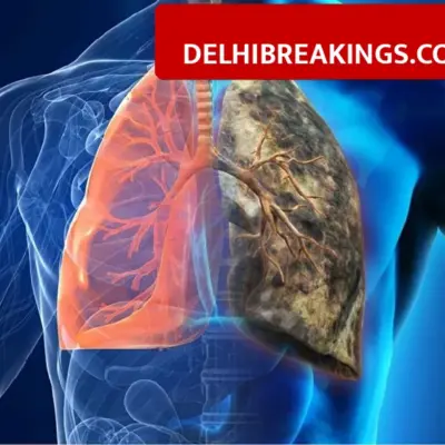 Delhi Men Beware, Doctors List 3 Cancers Spreading Rapidly Due to Pollution and Lifestyle
